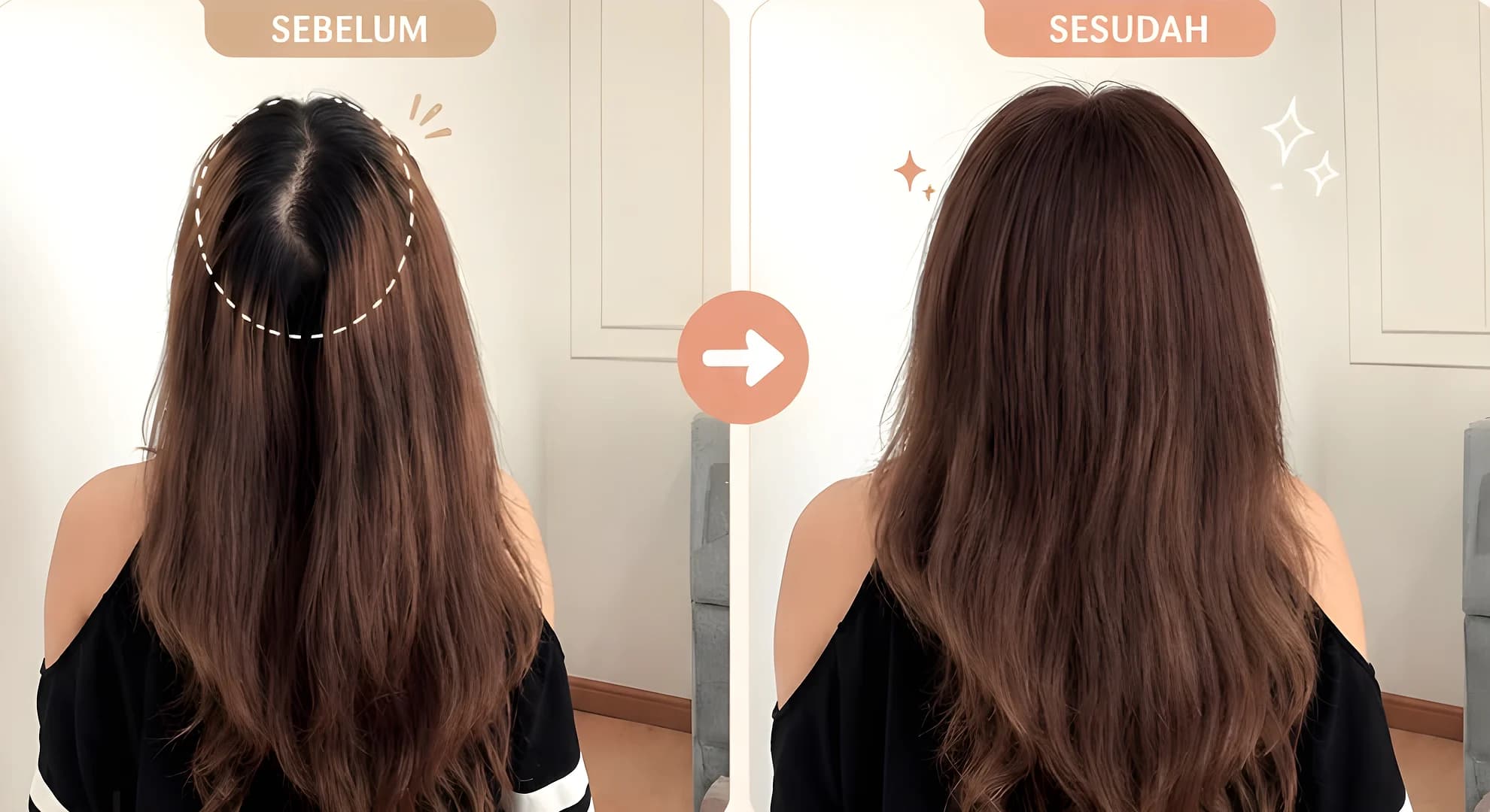 Sebelum dan sesudah memakai hair topper BYLIAN: area rambut tipis di bagian atas tertutup dan rambut tampak lebih penuh